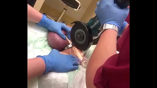 Homen tem seu pênis preso em anel peniano metalico